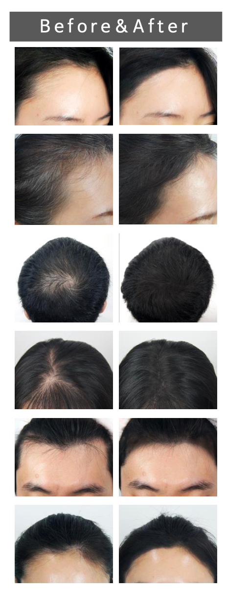 QUICK HAIR CUSHION