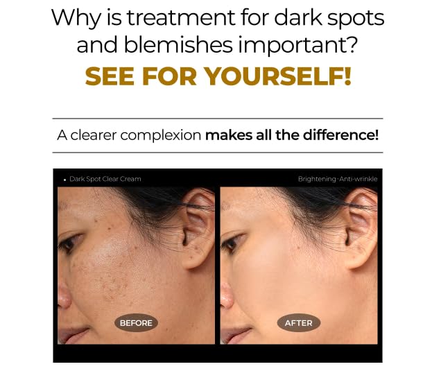 DEOPROCE Dark Spot Clear Cream, 30ml